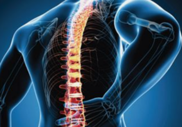 The Back Pain Epidemic: Exploring the Causes Behind 840 Million Sufferers